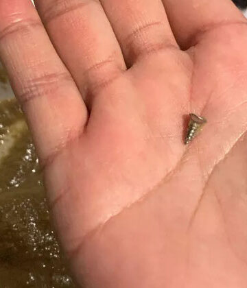 Metal Screw in Singapore Airlines Meal